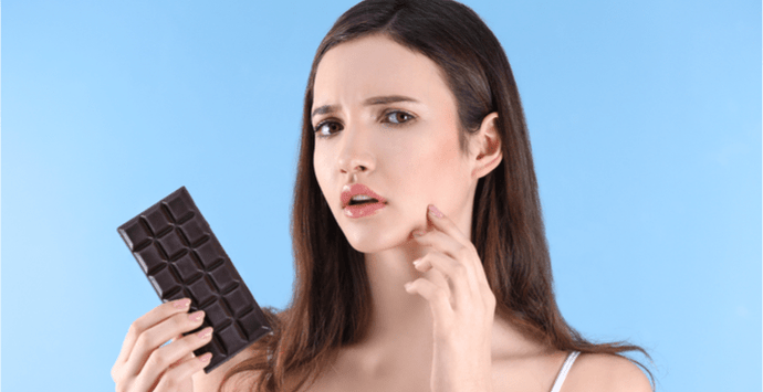 What Foods Cause Acne?  | The Top 6