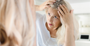 Post Menopause Hair Loss