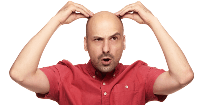 Is DHT the Cause of Male Pattern Baldness?