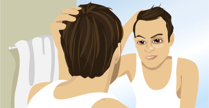 How to Stop Your Receding Hairline from Getting Worse