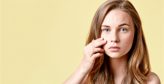 Here's Why Your Acne Won't Go Away