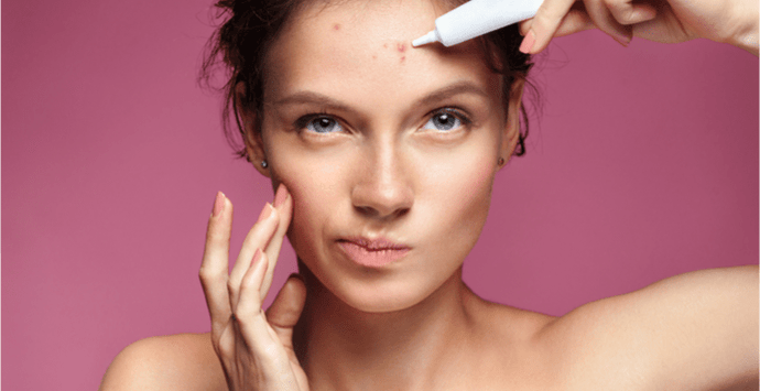 Forehead Acne: Doctors Explain How to Get Rid of It